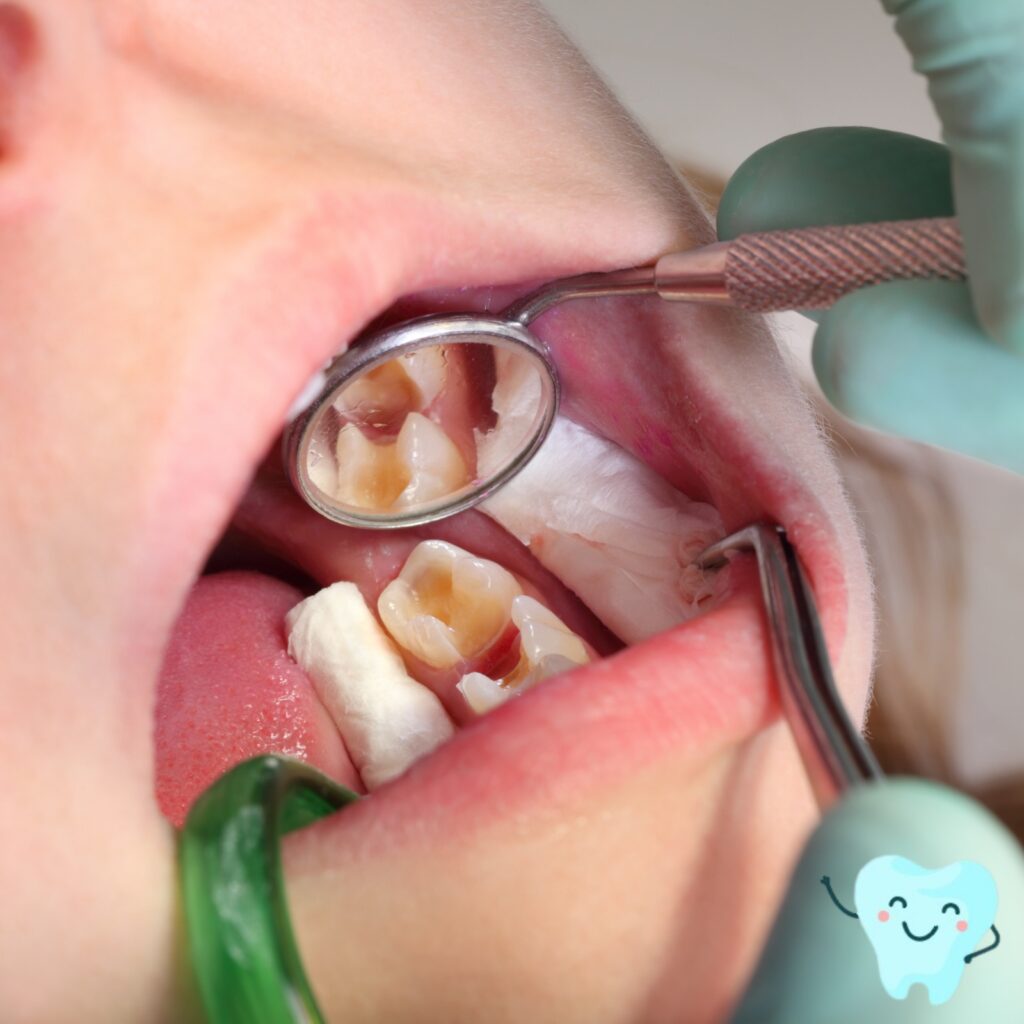 Restorative Dental Care