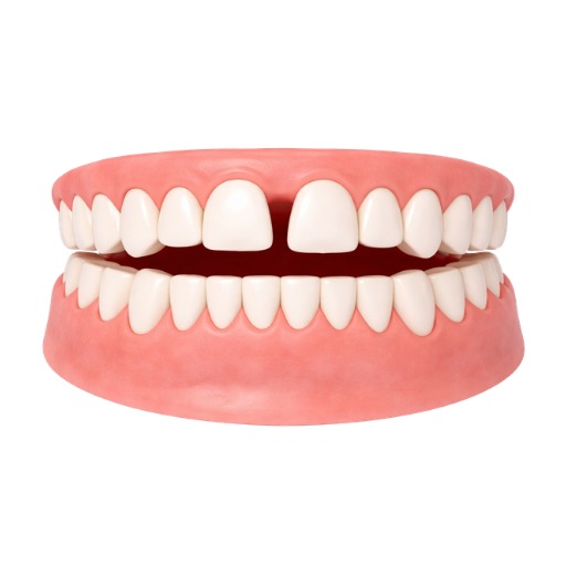 Teeth Gap